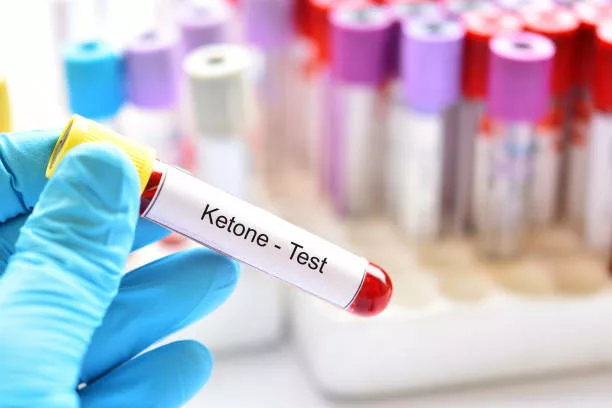 Ketone Test